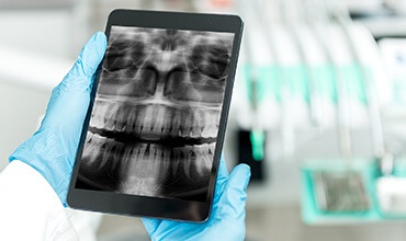 Dentist looking at dental x-ray on tablet